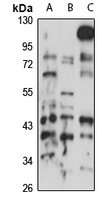 NSUN4 Antibody