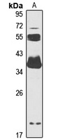 NT5C3 Rabbit Polyclonal Antibody
