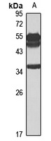 NT5C3 Rabbit Polyclonal Antibody