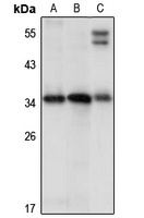 PNAD Rabbit Polyclonal Antibody