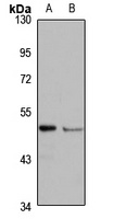 Netrin-5 Rabbit Polyclonal Antibody
