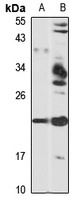 Neurotensin Rabbit Polyclonal Antibody