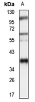 NUBP1 Rabbit Polyclonal Antibody