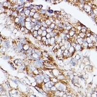 NUBP1 Rabbit Polyclonal Antibody