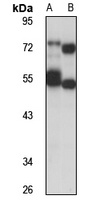 NUDCD1 Antibody