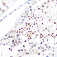 Anti-NUP50 Antibody