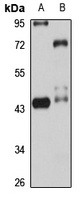 NUPL2 Antibody