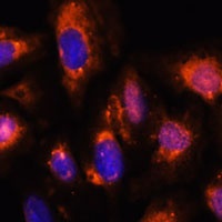 Anti-OAS3 Antibody