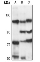 OGDHL Rabbit Polyclonal Antibody
