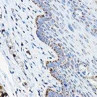 Anti-OGDHL Antibody