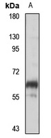 OGFOD1 Rabbit Polyclonal Antibody