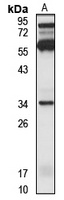 OR2S2 Antibody