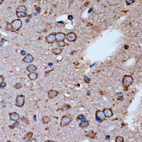 OR2S2 Antibody