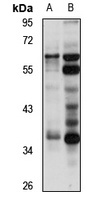 OR2T10 Rabbit Polyclonal Antibody