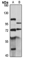 OS-9 Rabbit Polyclonal Antibody