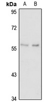 ORP-2 Rabbit Polyclonal Antibody