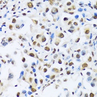 Anti-OTP Antibody
