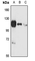 P2X5 Rabbit Polyclonal Antibody
