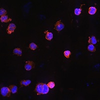 P2X5 Rabbit Polyclonal Antibody