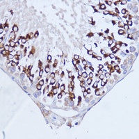 PABPC1 antibody