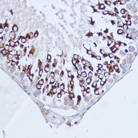 Anti-PABPC1 Antibody