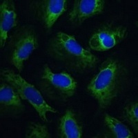 Anti-PABPC1 Antibody