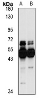 CBP Rabbit Polyclonal Antibody