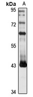 HPIP1 Rabbit Polyclonal Antibody