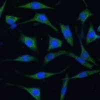 Anti-PALD1 Antibody