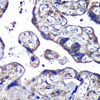 Anti-PASK Antibody