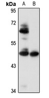 PBX1 Rabbit Polyclonal Antibody