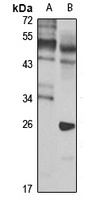 PBX1 Rabbit Polyclonal Antibody