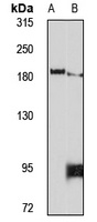 PCF11 Rabbit Polyclonal Antibody