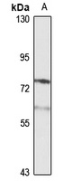 PCSK9 Antibody