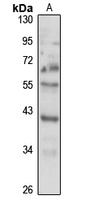 PDCD2 Rabbit Polyclonal Antibody