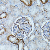 PDE3A antibody