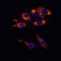 Anti-PDE3A Antibody