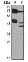 PDGFD Antibody