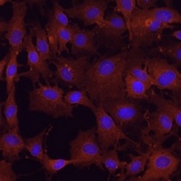Anti-PDHA2 Antibody
