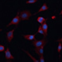 Anti-PDIA2 Antibody