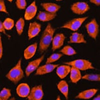 Anti-PDXP Antibody