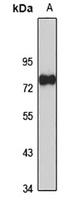Twinkle Rabbit Polyclonal Antibody