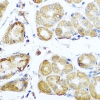 Anti-PER1 Antibody