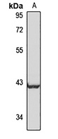 PEX12 Rabbit Polyclonal Antibody