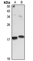 Prefoldin 4 Rabbit Polyclonal Antibody