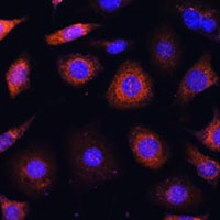 Prefoldin 4 Rabbit Polyclonal Antibody
