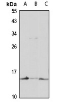 Prefoldin 5 Rabbit Polyclonal Antibody