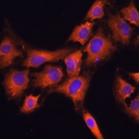 Prefoldin 5 Rabbit Polyclonal Antibody