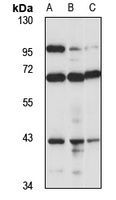 Pepsin A3 Rabbit Polyclonal Antibody