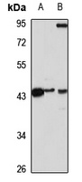 Pepsin A5 Rabbit Polyclonal Antibody
